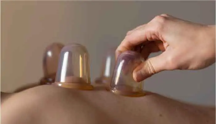 Dynamic Cupping Session
