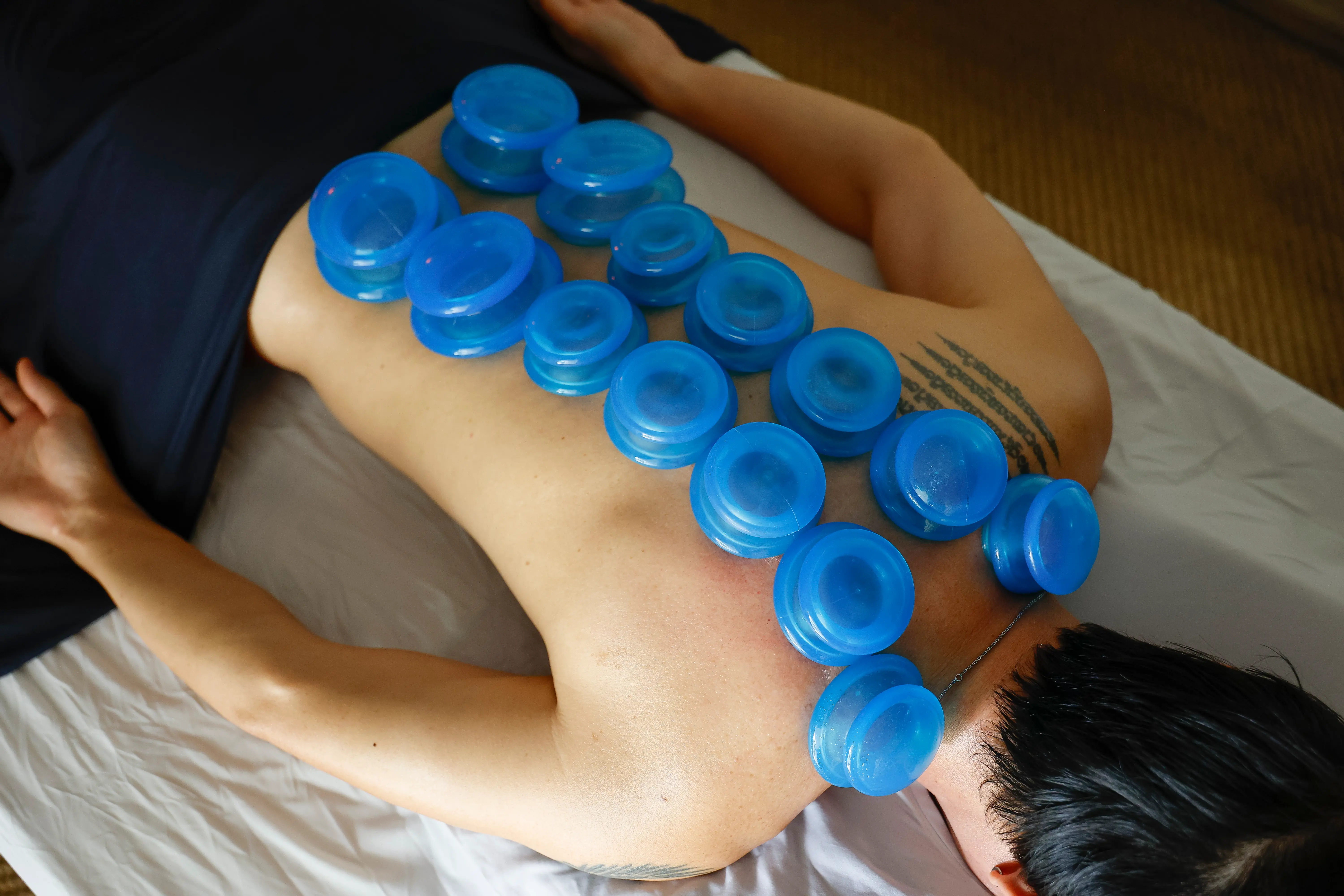 Dynamic Cupping Session demonstration at Thai Herb Massage